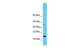 GAGE7 Rabbit anti-Human, Polyclonal, Novus Biologicals:Antibodies:Primary